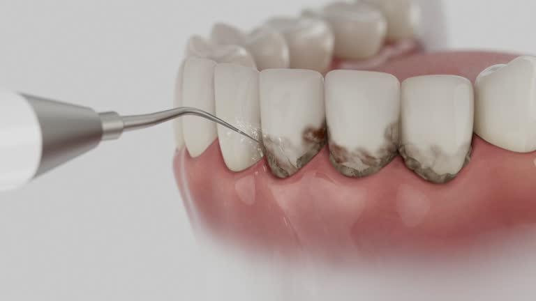 Trusted Dental Crowns And Bridges service in Parker, AZ - Dentist Open Now